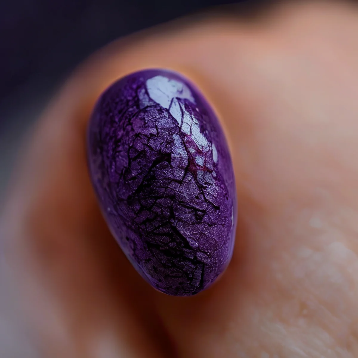Dark bruise on fingernail, visible under natural light.